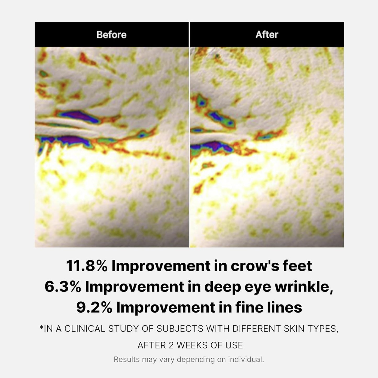 Medicube - Deep Lifting Eye Cream - 30ml