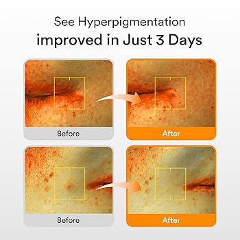 Abib - Glutathiosome Dark Spot Serum Vita Drop - 50ml